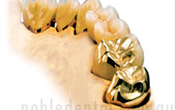 products-detail-gold-work
